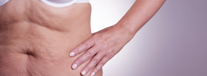 Wat is een diastase en wat kun je eraan doen? 1 buik buikwandcorrectie zwangerschap