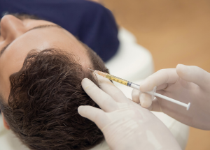 PRP contre la perte de cheveux : comment ça marche, étape par étape 5 a person getting injections in hair