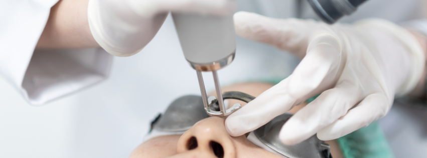 Laserbehandelingen in de zomer: kan dat eigenlijk wel? 1 zonneschade laser fotona huidveroudering