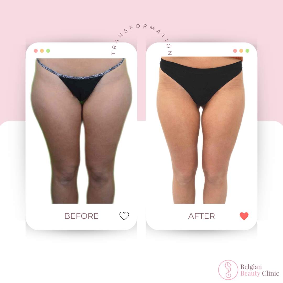 Before and after body transformation