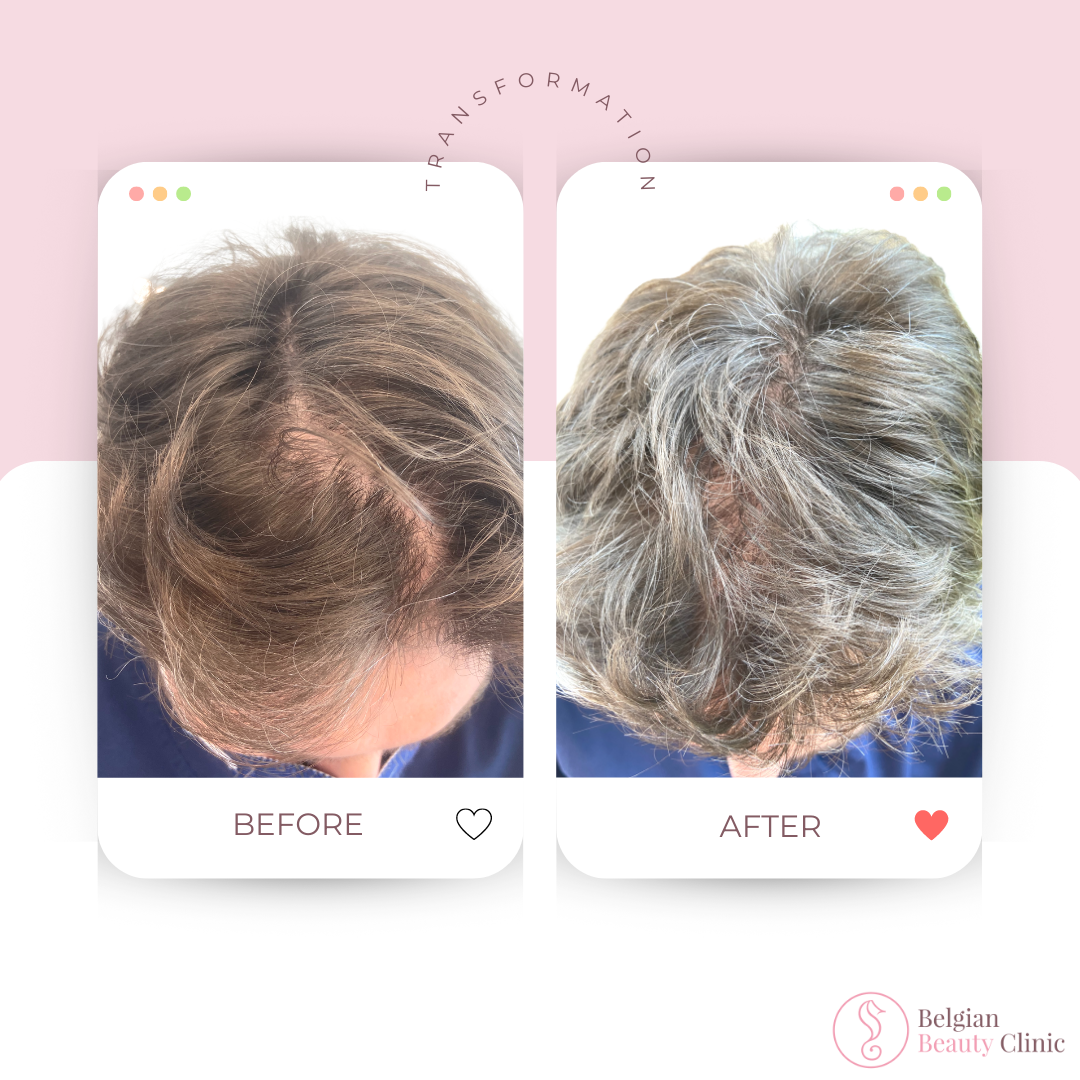 Hair transformation before and after