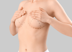 hangende borsten borstlift borstversteviging