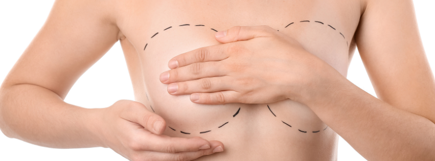 symastia postoperatief borstcorrectie