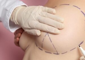 nr14c53d8d5b389ee94cb67fa9daad887cd